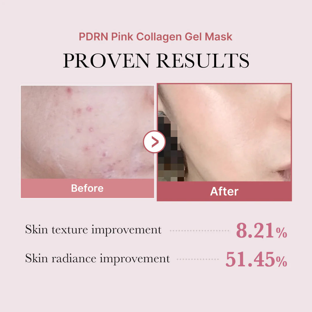 MEDICUBE Pink PDRN Gel Mask 4ea
